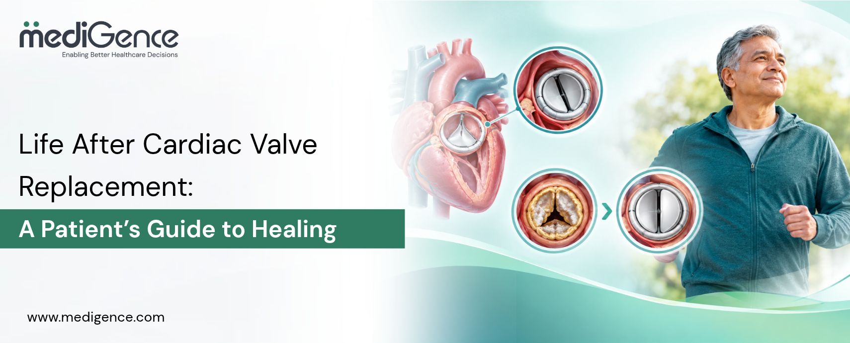 Life After Cardiac Valve Replacement: A Patient’s Guide to Healing